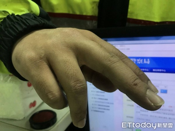 ���쉺���^���ֲ������������