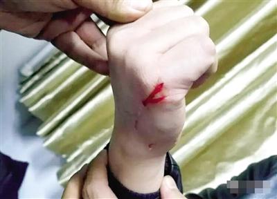 ���з��ٵ��ֱ�ץ��